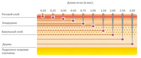 Мезотерапия